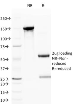 CD59 Antibody (BRA-10G), Novus Biologicals:Antibodies:Primary Antibodies